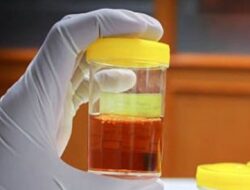 Ini Ciri Ciri Urine yang Mengindikasi Kerusakan Ginjal