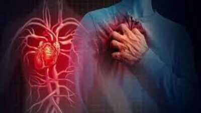 Ada Makanan Miliki Risiko Seseorang Terkena Stroke dan Serangan Jantung, Simak Penjelasannya