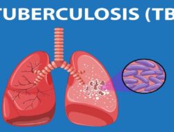 Kasus TBC di Lebak Menunjukan Tren Peningkatan