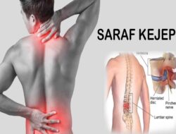 Tanpa Operasi, Saraf Kejepit Bisa Sembuh, Begini Penjelasannya